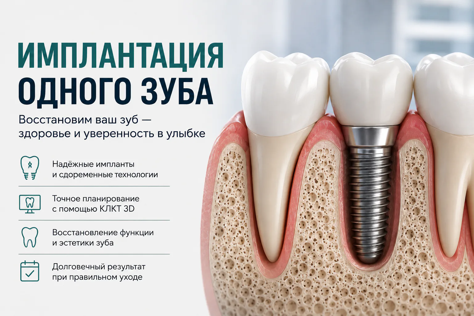 Имплантация одного зуба: зачем восстанавливать даже один отсутствующий зуб