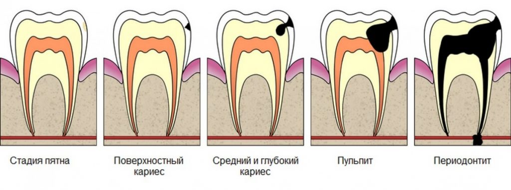 Сестринское дело в стоматологии | Академия РАДО